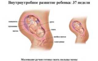 Головные боли 37 неделя беременности