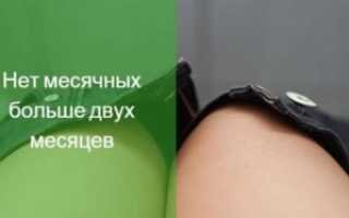 Из за чего у подростка задержка месячных