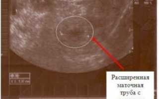 Через сколько дней после зачатия на узи видно плодное яйцо
