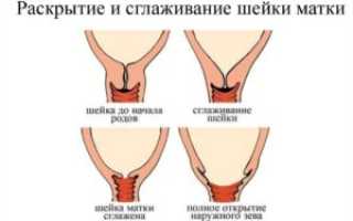 Созревание шейки матки перед родами