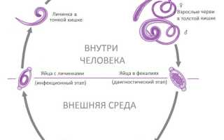 Личинки энтеробиоза в мышцах