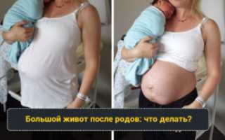 После родов большой живот почему