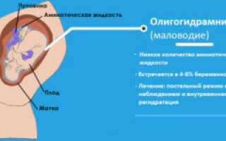 Маловодие при беременности 34 недели что делать