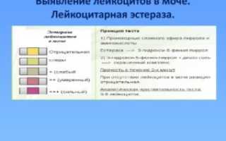 Следы лейкоцитарной эстеразы в моче у ребенка