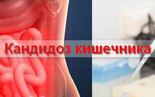 При кандидозе кишечника может быть крапивница