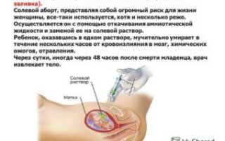 Можно ли заниматься интимной жизнью во время беременности на ранних сроках