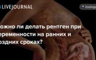 Можно ли при беременности делать рентген носа