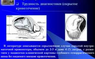 Отек плаценты при беременности причины